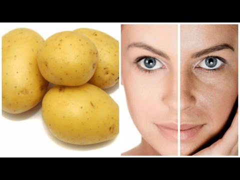 natural skin care at home with potato